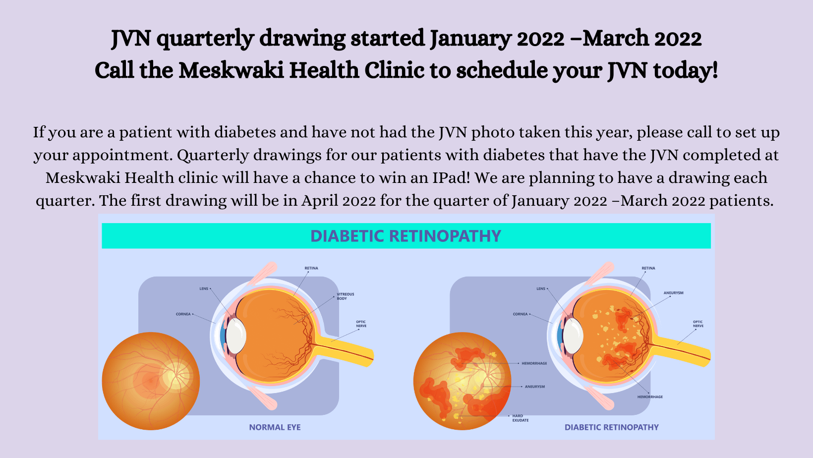 Diabetes Program to hold JVN Quarterly Drawing in April 2022